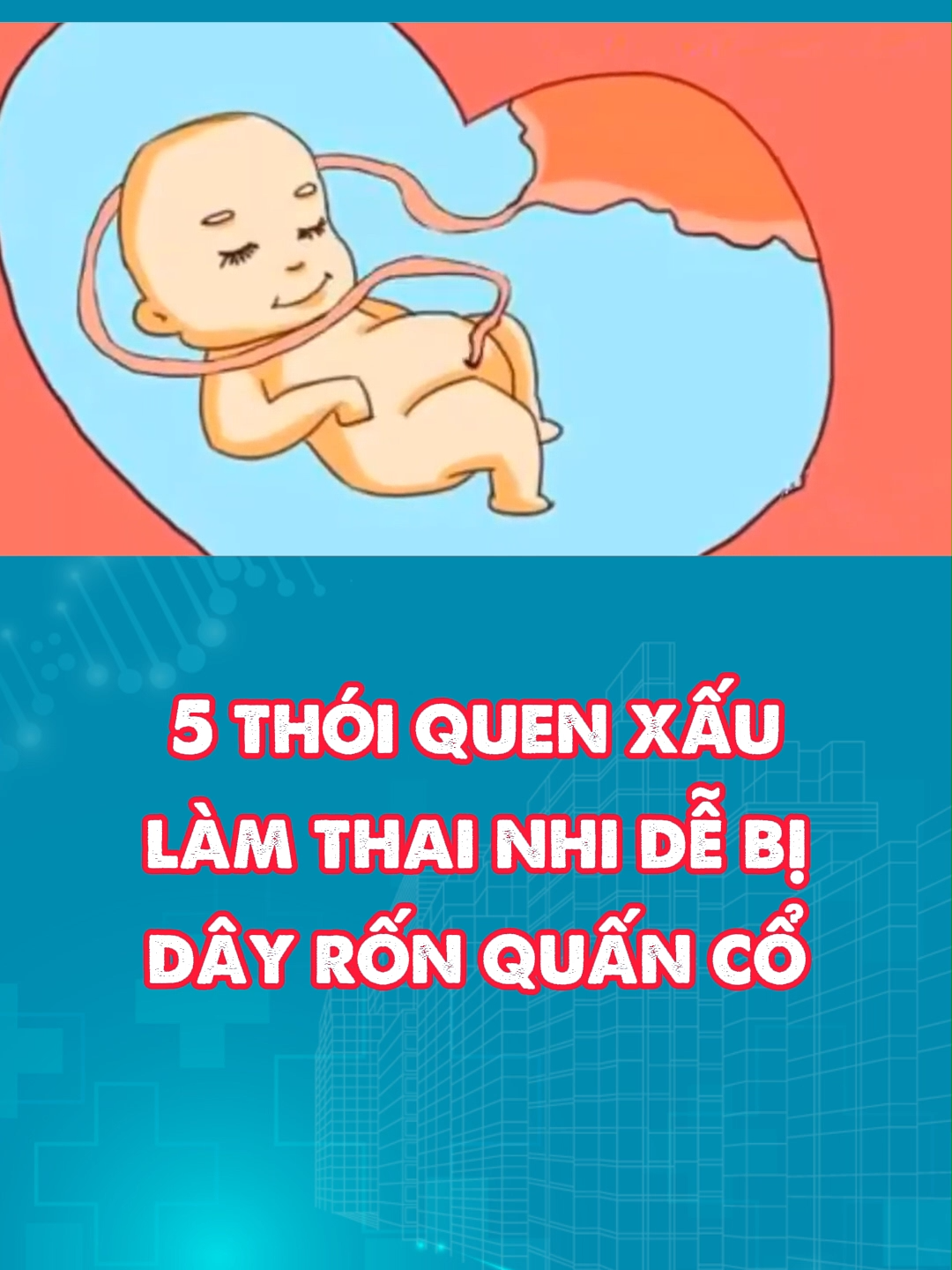 5 thói quen xấu làm thai nhi dễ bị dây rốn quấn cổ #mevabe #vivita #songkhoe247 #leanontiktok #vivitamebau #embedangyeu #xhtiktok #xuhuongtiktok2024