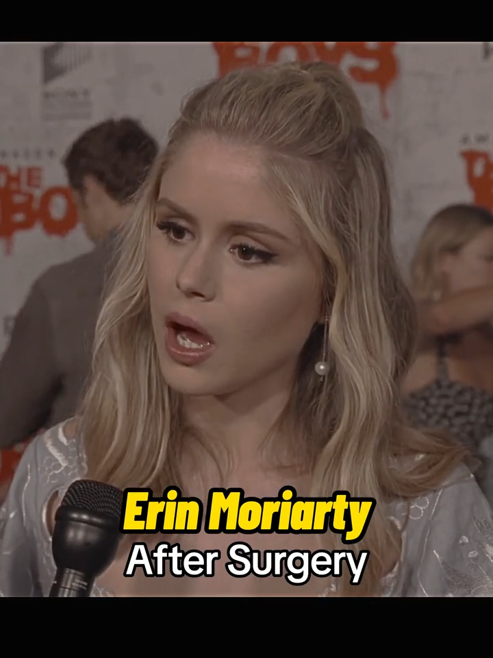 ERIN MORIARTY CHIRURGIE #erinmoriarty #theboysseason3 #transformation #serie #actrice #chirurgie