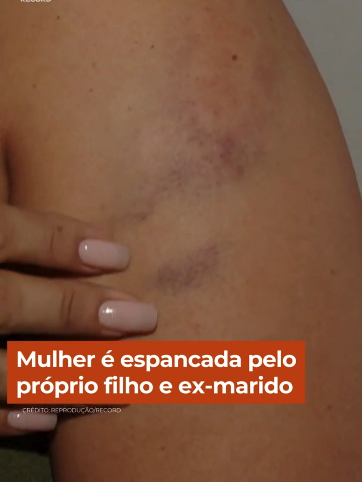 Vídeos registram o momento em que a vítima consegue sair da casa após ter sido cruelmente agredida pelo próprio filho e pelo ex-marido, com quem conviveu por 22 anos. Em outra gravação dá para ver o filho com um pau na mão. A vítima tentou se enconder antes que os suspeitos entrassem no local, mas eles arrombaram a porta. A briga teria sido motivada pela venda da casa após a separação do casal #CidadeAlerta Acesse R7.com/CidadeAlerta e veja essa e outras notícias