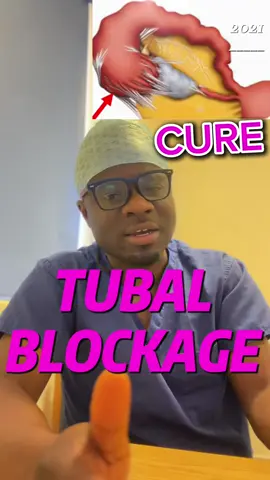 How you can cure tubal blockage #tubalblockage #fypシ゚ #fertile #cureinfertility #ivf #pregnancyjourney 