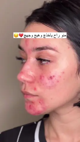 كولاجين الوجه الاخر الطبيعي الخالي من جميع المواد الكيميائية ومادة الكورتزون يعمل على تصفية وتبييض البشرة بشكل دائمي #كوزمتك_الوجه_الاخر #بشرة_صحية #تصفية_البشرة 