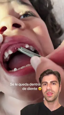 Grandma removing the last little bit of a baby tooth #dentist #teeth #babytooth #grandma 