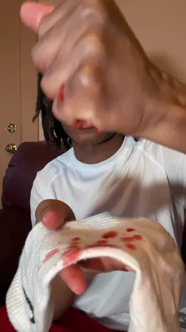Its actually crazy😭 #tiktokshop *those are strawberries tiktok🤦🏽‍♂️