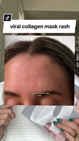 Its my duty as a content creator to share this since ive previously promoted this viral collagen mask…..  @AlexisChristine   @AlexisChristine  #skincare #collagenmask #deinfluencing #beauty #BeautyTok #fyp #fypage #skintok 