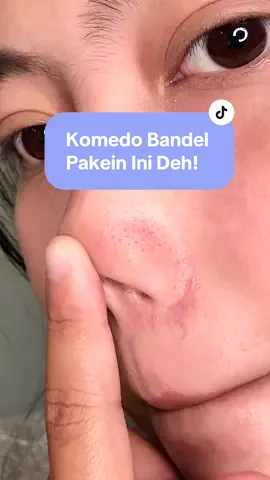 Tekstur peeling gelnya G2G yg paling gw suka! #peelinggel #eksfoliasi 
