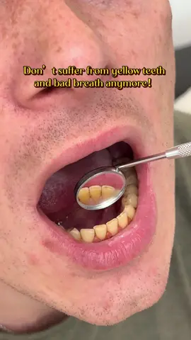 Wow I can’t believe this TikTok product worked.