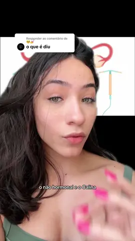 Respondendo a @🥺💅 minha experiencia com o diu 
