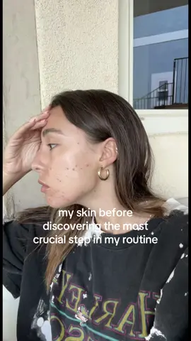 your tap water is ruining your skin🤮🤮🤮 #skincaretips #skincare #skintok #skincareroutine #skincareproducts 