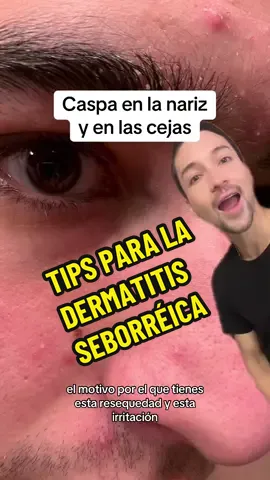 Tips para la dermatitis seborréica #skincare #skincaretips #seborreica #dermatitisseborreica #malazessia #pielgrasa #pielseca #caspa #dermatitisseborreica #barreracutanea #ketoconazol #azelaico #hidratacionrostro #longervideos #greenscreen 