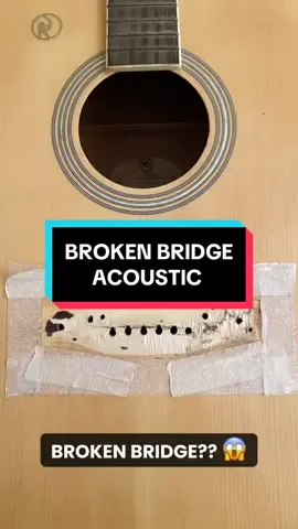 May napagaling nanaman tayong pasyente 😁 #brokenbridge #guitarrepair #acousticsetup #guitarsetup 