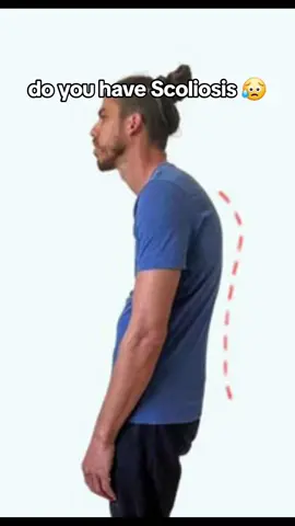 get your Posture Corrector today https://softspot-shop.myshopify.com #posturecorrector #backpain 