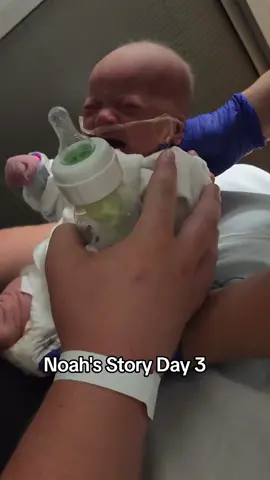 Noah's Story Day 3. Feeding. Babies with Down Syndrome have a hard time feeding and life is a bit of struggle for these warriors. (I'm about 2 weeks behind on memories because I was so caught up in the moment of everything that's going on with my sweet babe but today I'm taking some time to catch up on life and share this little warrior's journey). 💙💛 #foryoupage #foryou #syndromedown #syndrometiktok #nothingdownaboutit #💙💛 #trisomy21 #theluckyfew #downsyndromeawareness #downsyndrome #tiktokreels #reels #heartdefect #babyboy #feedingtime #oxygen #nicu #nicubaby #preemie #preemiestrong #noah #baby #babies #babiesoftiktok #babyeating #crying #cryingbaby #warrior 