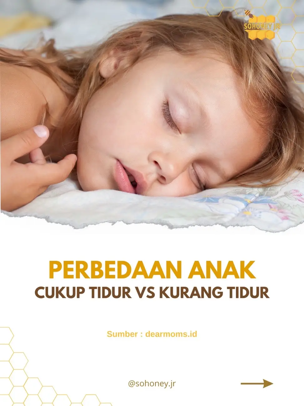 Bunda Ayah harus tau ya, perbedaan anak cukup tidur & kurang tidur🥰😍 #parenting #parentingtips #anakkurangtidur #sohoneyjr #maduvitaminanak #tipsanakmakanlahap #penambahnafsumakananak #solusigtm 