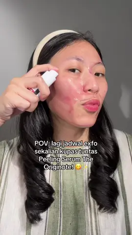 Replying to @ᯓ★ semoga membantu temen2 yang masih bingung exfo yah😙 #eksfoliasi #exfoliation 
