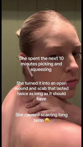 Must resist the urge 🧘‍♂️ who’s with me on the urge to pick ANY sight of a pimple immediately #acne #skincare #skincareroutine #bodyacne #acnetreatment #acneskin #acnefighter #skincaretips #businesstiktok #fyp 