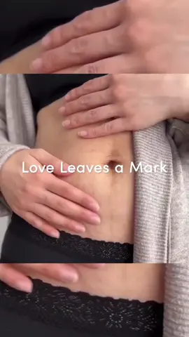 Coming soon… 💭  #stretchmarkcheck #stretchmarkoil #stretchmarkserum #stretchmarkcare #bellyoil #bellyserum #pregnancyskincare #postpartumbodylove #stretchmarklove 