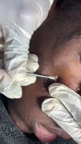 Thanks for choosing @adeolas__beautyspa🧖‍♀️🫠#adeolas_beautyspa #100kviews #facial #acnetreatment #viralvideo #spa #CapCut 
