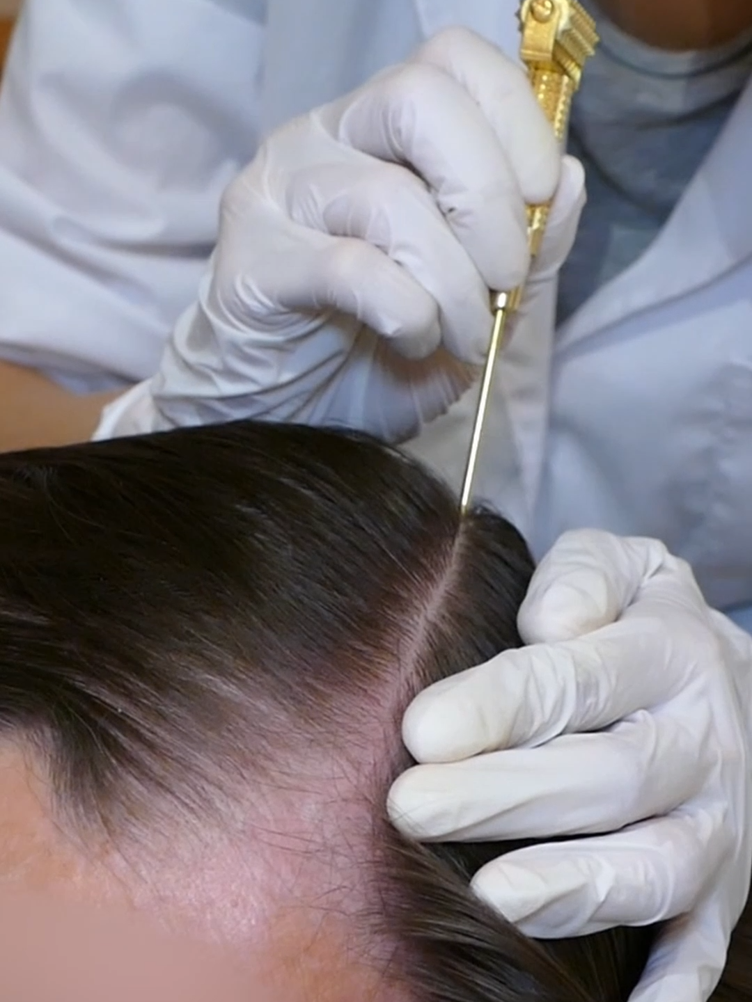 ASMR Medical SCALP Exam with Sensory Tests, Sharp or Dull, Combing (Real Person) #asmr #asmrsounds #asmrvideo #asmrtiktoks #scalp #scalpcheck #asmrsensory #asmrroleplay #asmrmedical #asmrdoctorroleplay