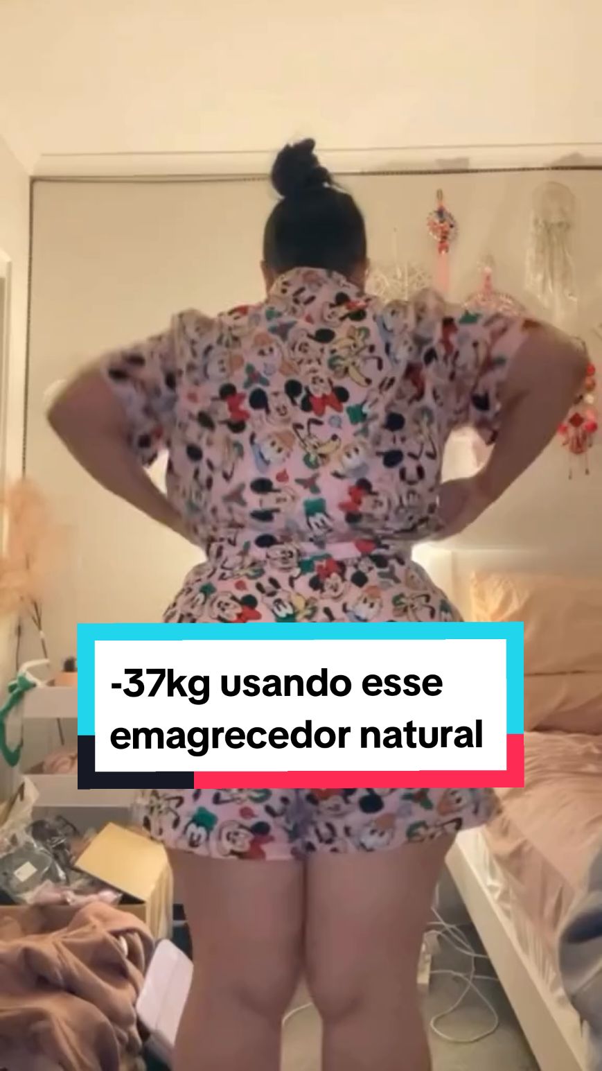 -37kg 😱 #emagrecimento #sibutramin #antesedepoisemagrecimento 