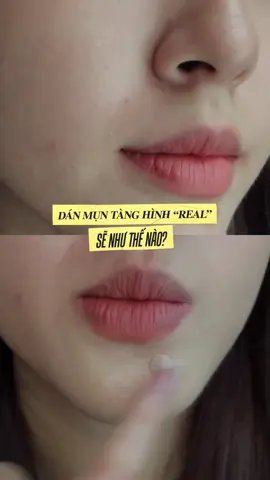 😎 NHƯ THẾ NÀO LÀ DÁN MỤN TÀNG HÌNH 