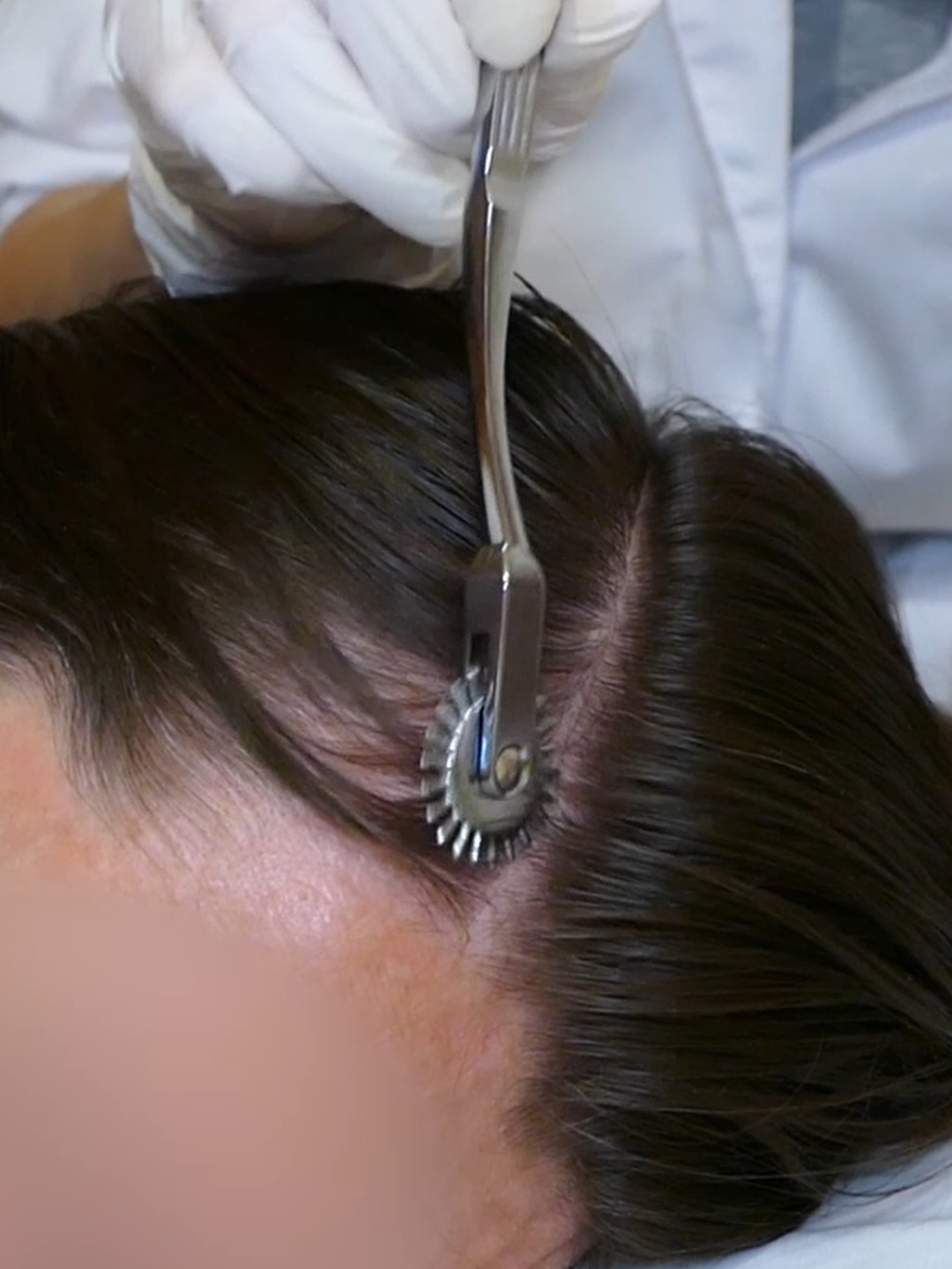 ASMR Medical SCALP Exam with Sensory Tests, Sharp or Dull, Combing (Real Person) #asmr #asmrsounds #asmrvideo #asmrtiktoks #scalp #scalpcheck #asmrsensory #asmrroleplay #asmrmedical #asmrdoctorroleplay