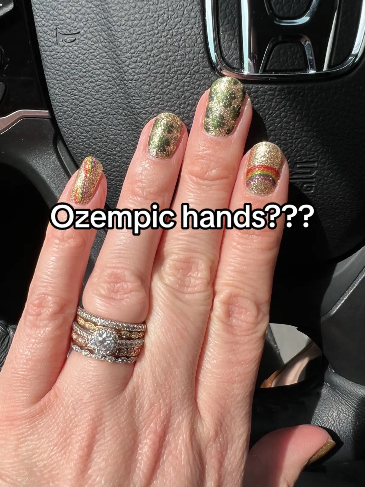 Mounjaro, Zepbound, Compound Tirzepatide have decreased my swelling, joint pain, inflammation, and pcos symptoms. Not Ozempic 🤣 #pcos #insulinresistance #mounjaro #ozempic #inflammation #beforeandafter 