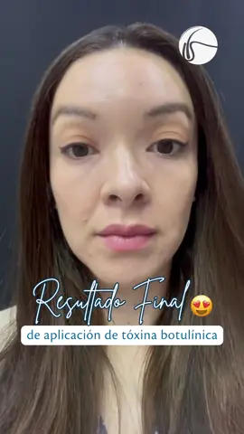 Nosotros te haremos ver siempre joven 🥰😊.. Resultados increíbles 💉 #botox #dermatologo #rostro  #skincare #fyp #elsalvador 
