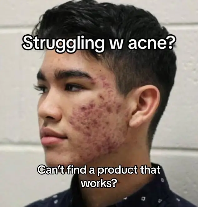 You gotta try this out😳 #mensessentials #skincare #acne #moisturizer #wash #beauty #fyp #motivation #inspo 