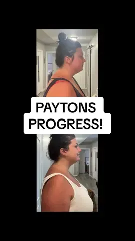LETS GIVE @pro.play.in_k A BIG “YOU GO GIRL!!” 🤩👏🏼 Amazing results after just 5 days! Stay tuned for her continued progress! #paytonstransformation #beforeandafter #forwardheadtilt #roundedshoulders #neckhump #dowagershump #mysticalposturedemo #mysticalpostureroutine #15minutepostureroutine #15minutepostureimprovementroutine 