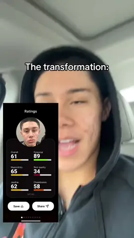 Transformation was absolutely insane @Umax App #acne #acnetreatment #skincare #skincareroutine #clearskin 