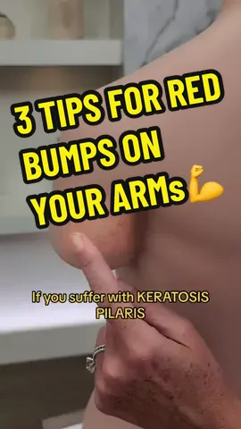 3 Tips For Red Bumps On Arms💪 Dr. Janine shares 3 tips for dealing with red bumps on arms, including using whole food vitamin C and incorporating carrots into your diet. Say goodbye to keratosis pilaris with these beauty tips!  #arms #keratosispilaris #vitaminc