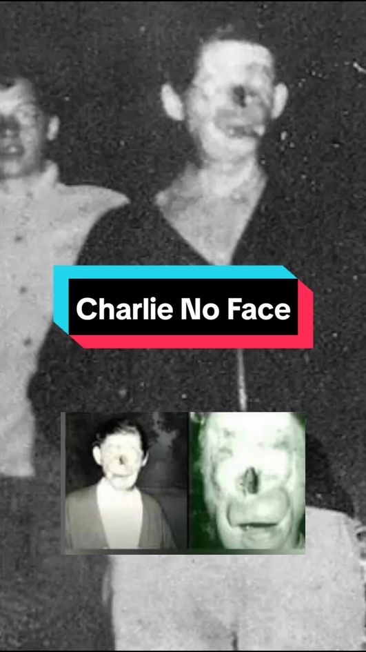 Charlie No Face Story Pt1:  This is the story of Raymond Robinson a man who lived in the 1910s and was know as Charlie no face or the Green man  #scarytiktoks #storytelling #horror #urbanlegend #scarystories #scary #horrortok #horrorstory #history #pennsylvania 