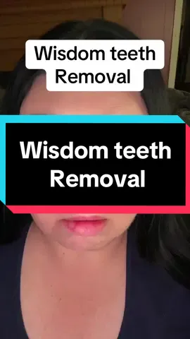 Part 1 wisdom teeth removal #Tamberlynne #Tammy #wisdom #wisdomteeth #dentist #doctor wisdom teeth removed funny videos hilarious wisdom teeth videos Tooth Gems Amazon Kit you are white original video Puppy Funny Videos Small Teeth people faking wisdom teeth videos funny videos after getting.     wisdom teeth anesthesia funny videos How To Brush Teeth Properly people getting their wisdom teeth out black people ... wisdom teeth funny videos ellen Fang Teeth hilarious old wisdom teeth videos anesthesia videos after getting wisdom teeth out funny videos of people getting their wisdom teeth...