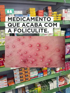 Medicamento que acaba com a foliculite.   #medicamentos #farmacia #saude #bemestar #drogaria #pele #foliculite #furunculo #peloencravado #bacteria 