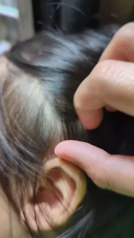 No more kuto na ang mga kids! Super effective sa lahat ng product na nasubukan ko. Head lice shampoo safe for kids & adults! 🩷 #headlice #lice #kuto #nomorekuto #fypシ゚viral #fyppppppppppppppppppppppp 