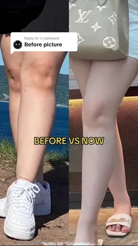 Full body whitening fast and hand!Yellow and black skin turns into cold white skin #fyp #aisaseaph #aisasea #foryou #whitening #milkskincare #beauty #aisaseabodylotion L358