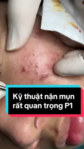 Kỹ thuật tốt thì cây hay tay gì cũng đc #xuhuong #winspavungtau #spa #xuhuongtiktok 