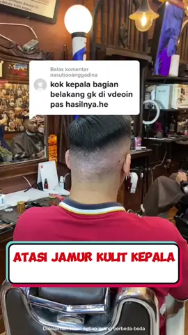 Atasi jamur kulit kepala Cukup satu langkah mudah #shampokirozi #shampoketombe #ketombetreatment