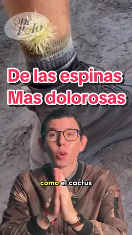 De las espinas más dolorosas que existen 😳😳😳 más en IG #polomed #medicina #AprendeEnTikTok #SabiasQue #cienciaentiktok 