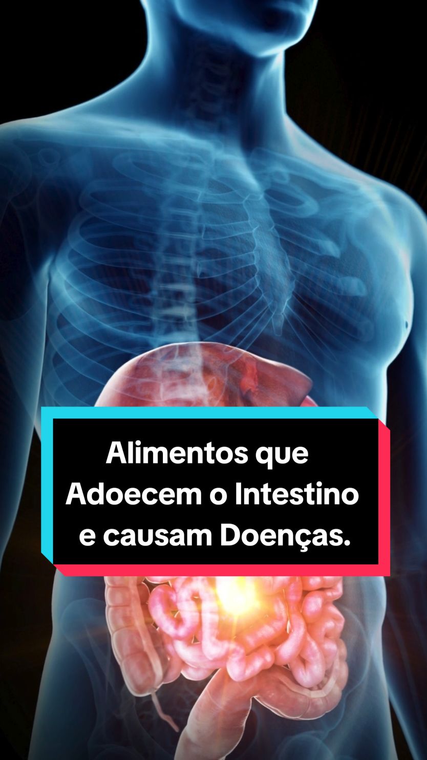 Alimentos que Adoecem o Intestino e causam Doenças. #intestino  #doença 