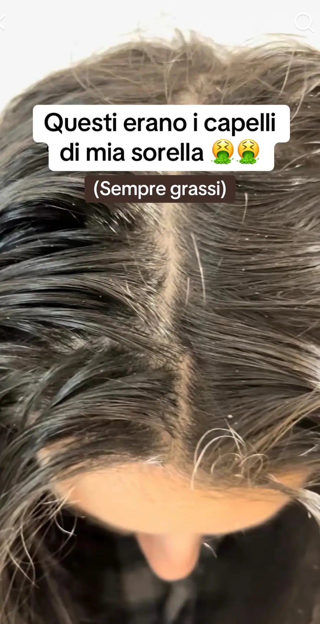 Come lavare i capelli grassi #capelligrassi #capelligrassirimedi #capelligrassicheck #capelligrassitips #addiocapelligrassi #capelligrassiaddio #capelliunti #capelliuntiebisunti 