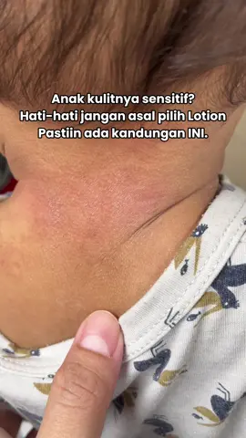 Walaupun eksim dan ruam udah sembuh, tetap rutin pakai lotion expert care (colloidal oatmeal dan ceramide) ya bund untuk pencegahannya ✅ #lotionexpertcare #skincareanak #skincarebayi #expertcare #eksimbayi #kulitbayisensitif #newborn #wibgajian 