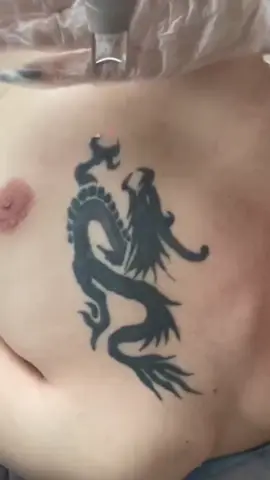 Ai cũng có 1 thời tuổi trẻ!  #xoaxam #laser #laserpico #xoahinhxam #xamhinhnghethuat #tatoo 