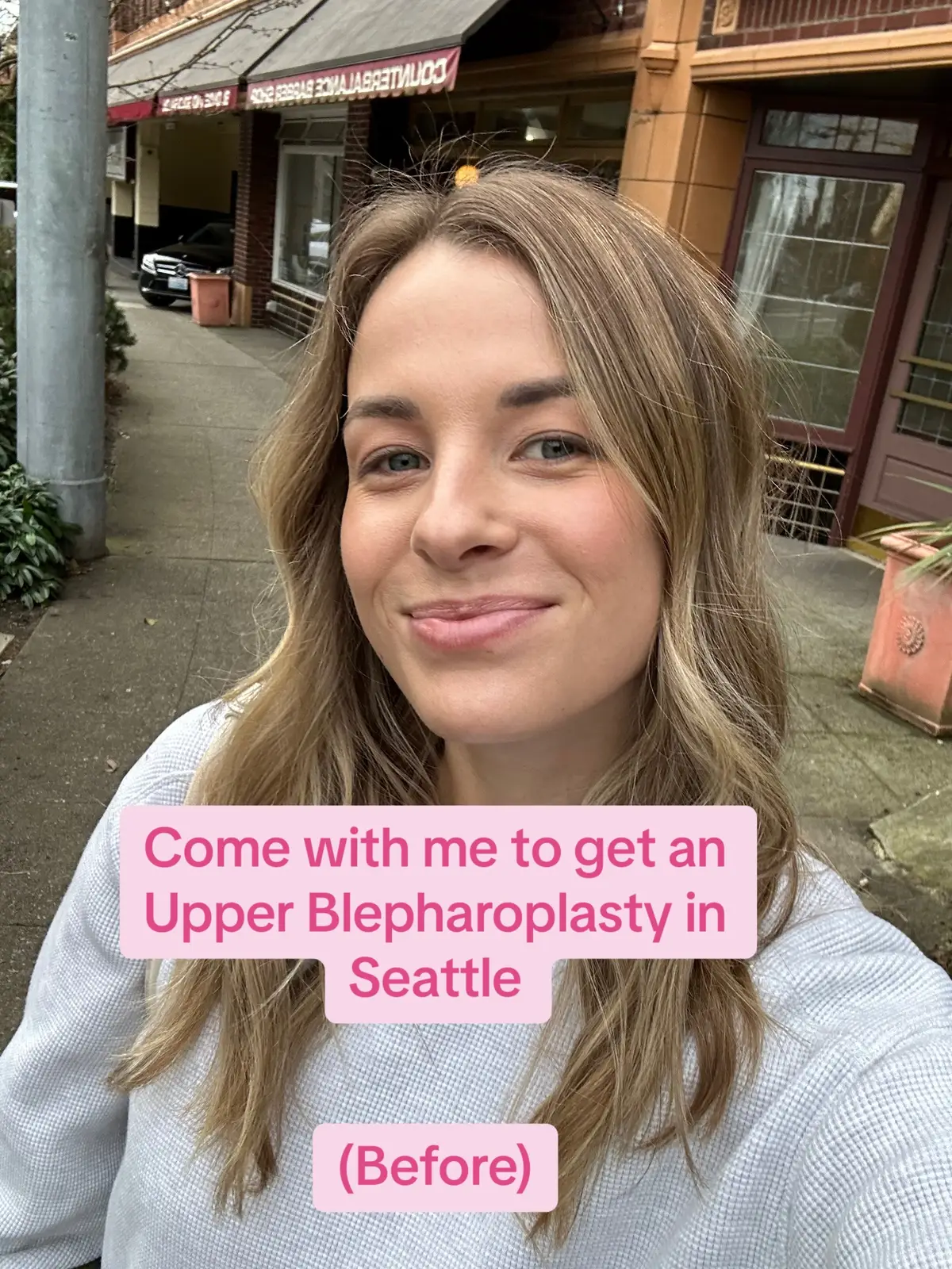 I’m 28 and I highly recommend doing this if you have been thinking about it! #upperbleph #cosmetics #plasticsurgeonsoftiktok 