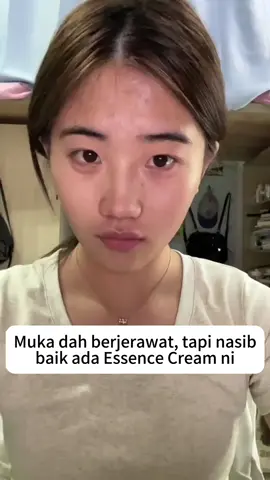 Smooth wrinkles and sacars with Zhenshi Essence Cream #scar #wrinkle #stretchmarks #pregnat #tiktok #tintokshop 