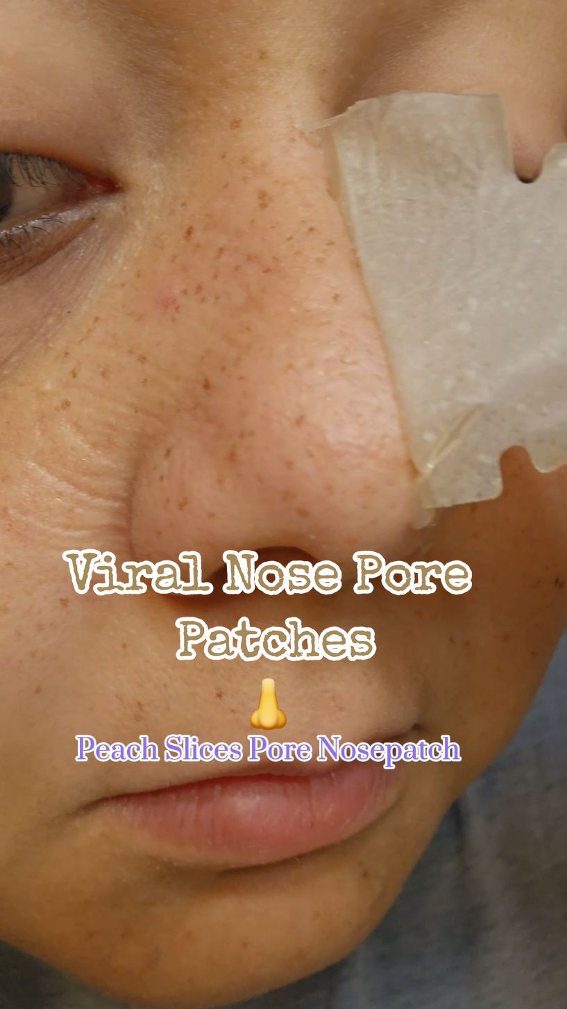 Weirdly disgusting but yet so satisfying 😌 my nose feels soft and renewed after removing all the gunk from it.  @Peach Slices 🩵 #peachslices #nosestrips #renewed #porepatches #viral #patches ##foryou 