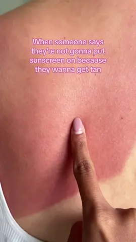 Its not worth it✨Stay protected from harmful UV rays with our Australian made SPF 50+ Body sunscreen! ⚡Flash deal⚡30% off sunscreen!  ✨ultra lightweight & never greasy ✨skin-loving aloe vera and antioxidants  ✨safe for sensitive skin  ✨water-resistant up to 4 hours  #cocoandeve #sunburn #Summer #tanning #spf #sunscreen 