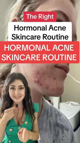 Keep it as simple as this - Best hormonal acne skincare routine to keep your pimples under control (FREE Acne E-book available in bio) #acne #hormonalacne #acnetreatment #acnefighter #hormonalacnesolution #acneskincare 