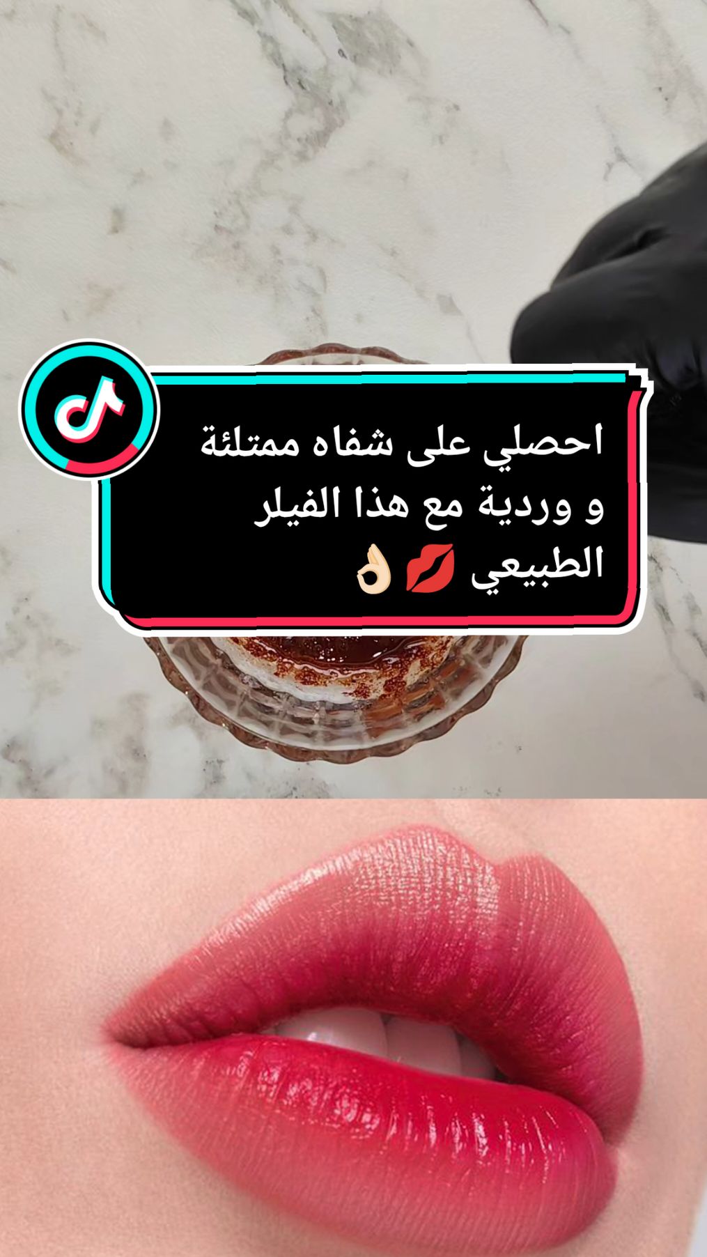 وصفة طبيعية لنفخ الشفايف و توريدهم #وصفات_طبيعية #شفايف #فيلر_شفايف #توريد_شفايف #أسرار #fyp #foryourpage #فرنسا🇨🇵_بلجيكا🇧🇪_المانيا🇩🇪_اسبانيا🇪🇸 @أسرار @أسرار @أسرار 