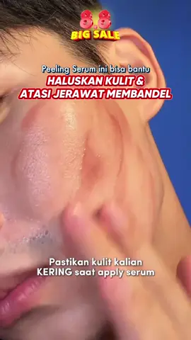 ‼️ Bukan sulap, bukan vampir, apalagi darah! 🩸 Ini dia Skintific Peeling Solution, terbaru dari Skintific! 🔥 #skintific #skintificid #skintificindonesia #skincare #skin #skinbarrier #acneprone  #glowing #fyp #peeling #exfoliation 